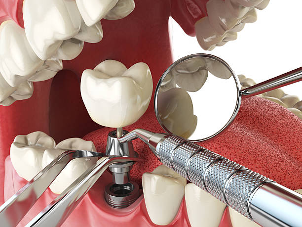Best Emergency Root Canal Therapy in Wakefield, NE